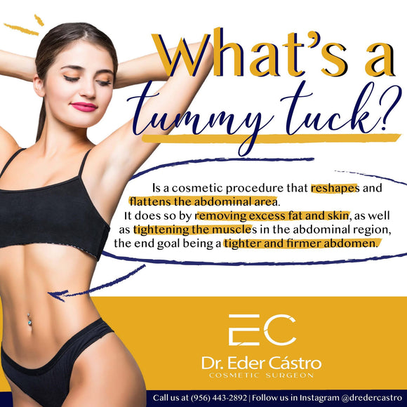 Abdominoplasty/Tummy Tuck (deposit only)